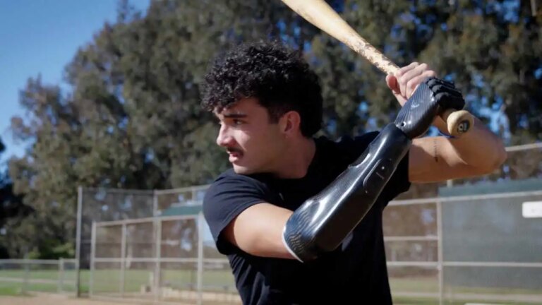 Player with bionic hand returns to baseball after losing hand in firework accident