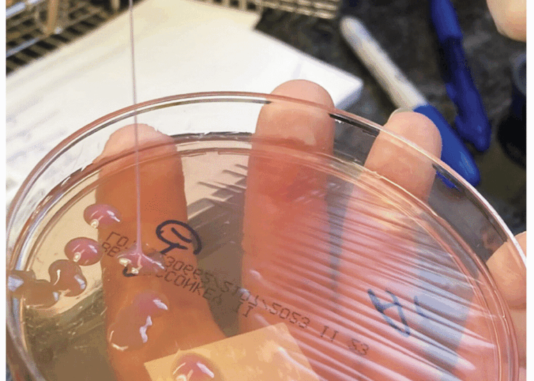 This may be the grossest eye pic ever—but the cause is what’s truly horrifying This may be the grossest eye pic ever—but the cause is what’s truly horrifying