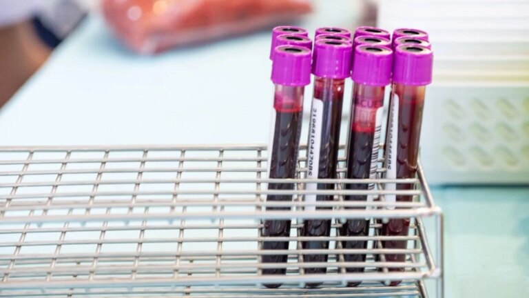 A Simple Blood Test Could Eventually Tell You When Alzheimer’s Is Coming A Simple Blood Test Could Eventually Tell You When Alzheimer’s Is Coming