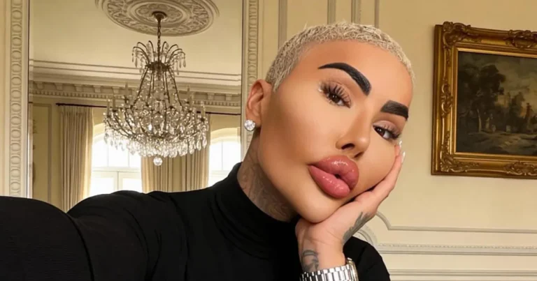 Botched's Jordan James Parke Dead After Possible Cosmetic Procedure