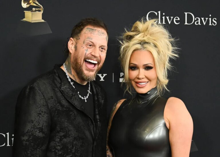 Jelly Roll’s Penis Is ‘Severely Bigger’ After Weight Loss Jelly Roll's Penis Is 'Severely Bigger' After Weight Loss