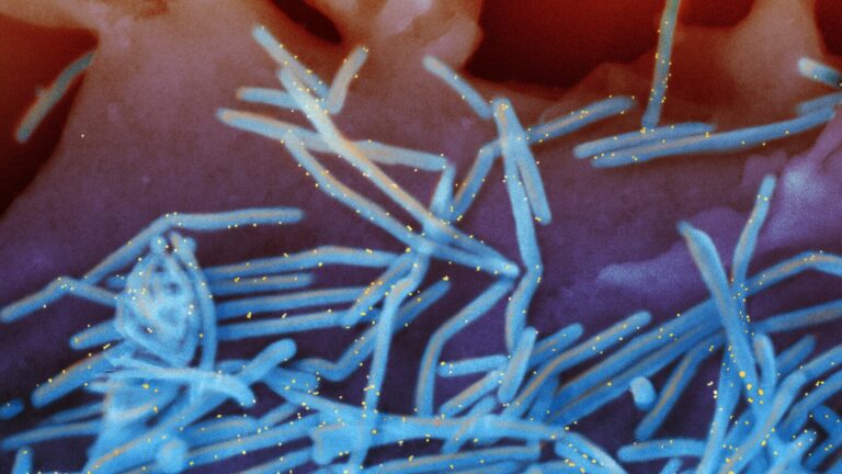 RSV shots for babies under FDA review despite evidence of safety : NPR